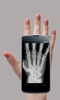 X_Ray Scanner screenshot 11