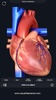 Heart Anatomy Pro. screenshot 12