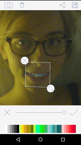 Braces - Preview 2