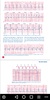 ECG / EKG Rhythm Step-by-Step Interpretation screenshot 2