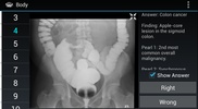 Radiology Flashcards: Free screenshot 3