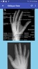 Upper Limb Radiographic Positioning screenshot 3