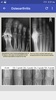 Musculoskeletal X- Rays Interpretation screenshot 4