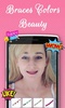 Braces Colors Beauty screenshot 1