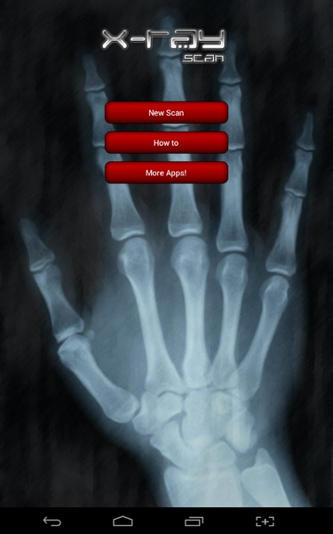 X-ray Scan - Preview 1