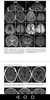 Imaging Brain, Skull & Craniocervical Vasculature screenshot 1