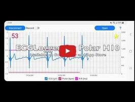 Video về ECGLogger1