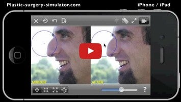 Plastic Surgery Simulator1 hakkında video