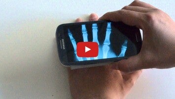 طريقة لعب الفيديو الخاصة ب Xray Prank1