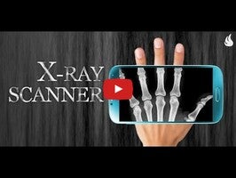 Vídeo de X-Ray Scanner 1