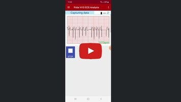 Video su Polar H10 ECG Analysis 1