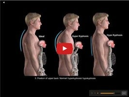 Vídeo sobre Posture by Muscle & Motion 1