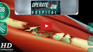 Gameplay video of Operate Now: Hospital 1